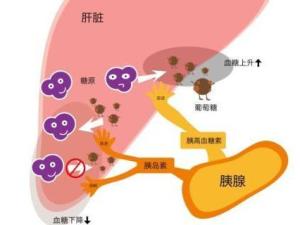 胆汁