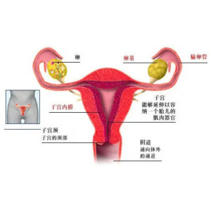 女子胞