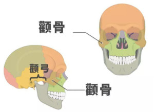 颧骨