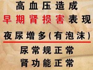 肾阴虚