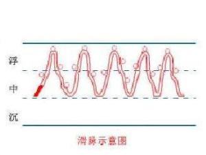 滑脉 滑脉