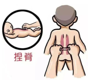 捏脊