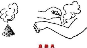 艾炷