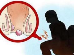 痔