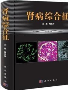 肾病综合征