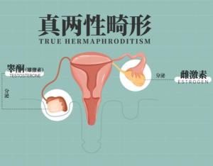 两性畸形