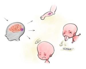 病毒性脑膜炎