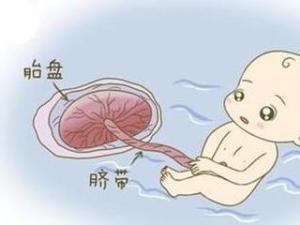 胎膜早破