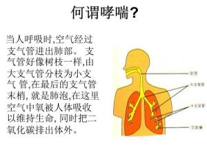 哮喘病