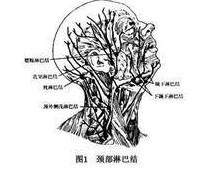 恶性淋巴瘤