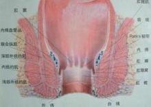 肛门癌