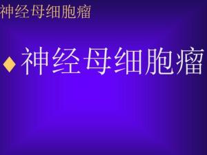 神经母细胞瘤