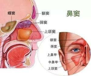 鼻窦炎鼻窦炎