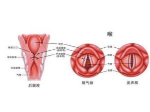 喉炎 喉炎