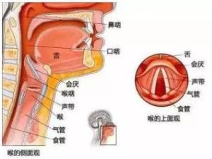 急性会厌炎