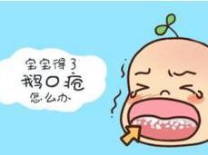 鹅口疮