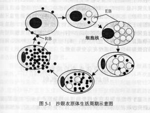 沙眼