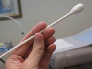 淋病检查