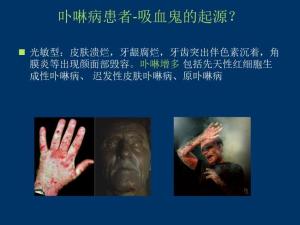 卟啉病