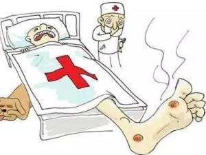 糖尿病足