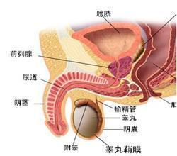 急性腮腺炎性睾丸炎