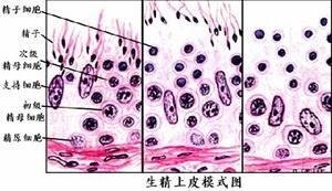 无精子症