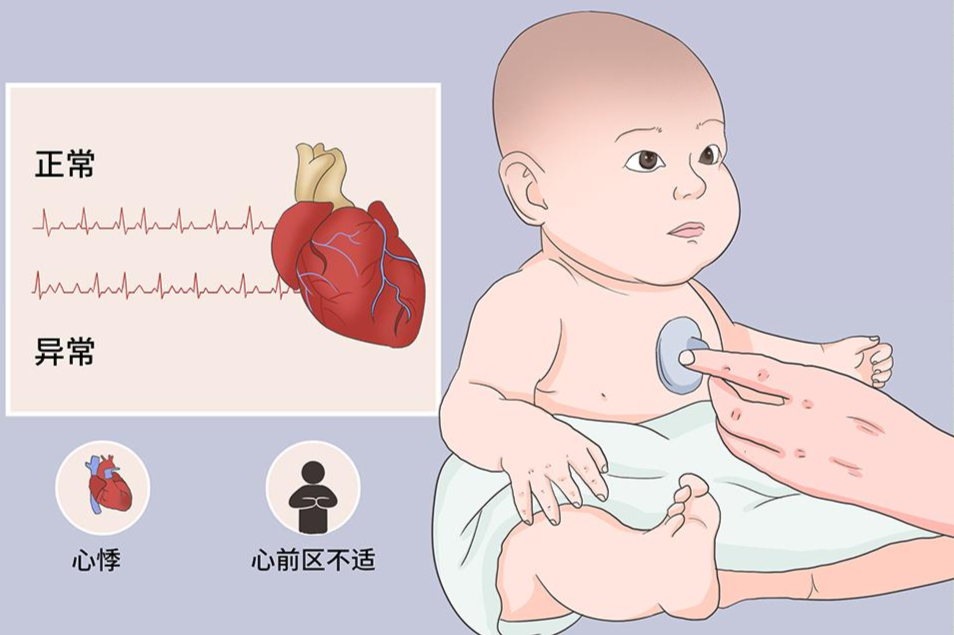小儿期前收缩