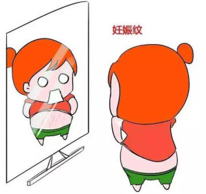 妊娠纹