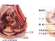 异位妊娠