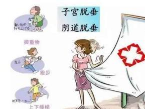 阴道前壁膨出