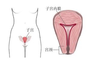 子宫内膜增生
