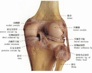 骨质增生