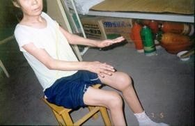 风湿病