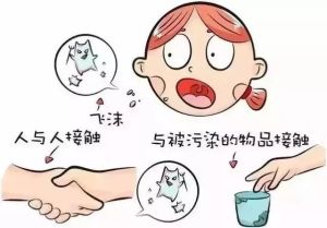 重症急性呼吸综合征