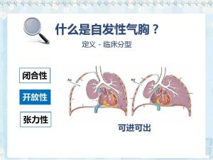 气胸图册