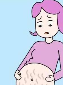库欣综合征