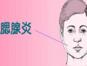 腮腺炎