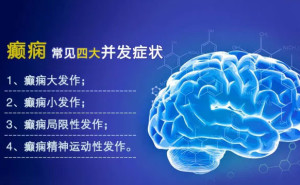 癫痫