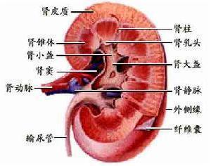 肾盂肿瘤