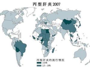 丙型病毒性肝炎