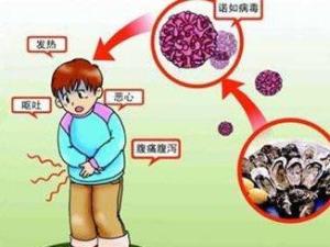 胃肠功能紊乱