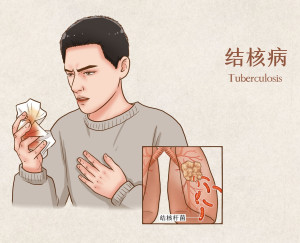 结核病