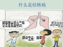 结核病