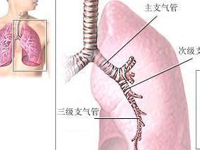 支气管炎