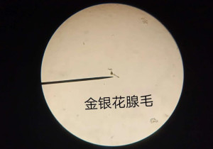 腺毛