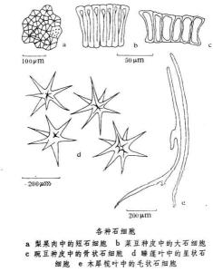 石细胞的细胞图