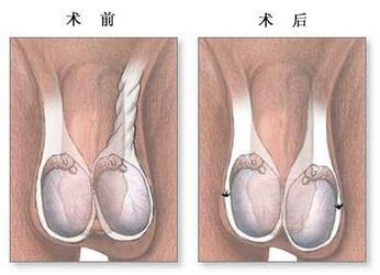 睾丸