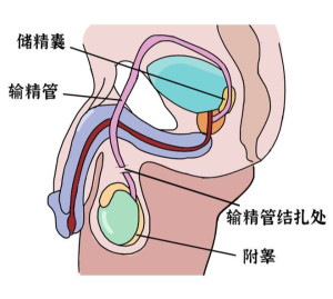 输精管