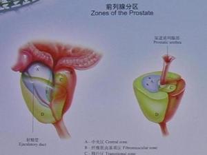 前列腺