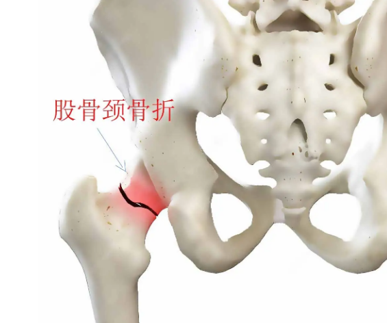 股骨